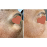 MELA DEFENSE WHITENING SERUM, 30 гр