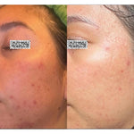 MELA DEFENSE WHITENING SERUM, 30 гр